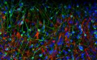 Images of vessels derived from induced pluripotent stem cells (green) (Photo: Rakesh Karmacharya / Harvard Stem Cell Institute) Images of vessels derived from induced pluripotent stem cells (green) (Photo: Rakesh Karmacharya / Harvard Stem Cell Institute)